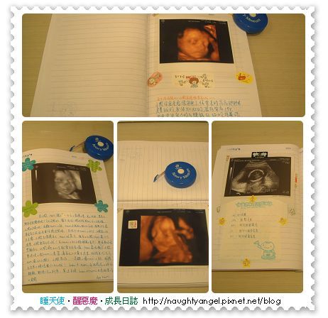 寶寶4d攝影vs 高層次超音波 睡天使醒惡魔成長日誌